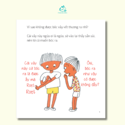 bi mat cua vay vet thuong 3